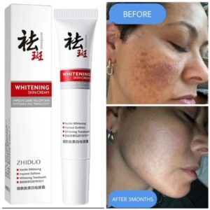 whitening cream